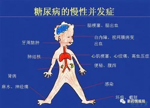 但其实糖尿病本身并不可怕,可怕的是其并发症给患者带来的折磨和危害