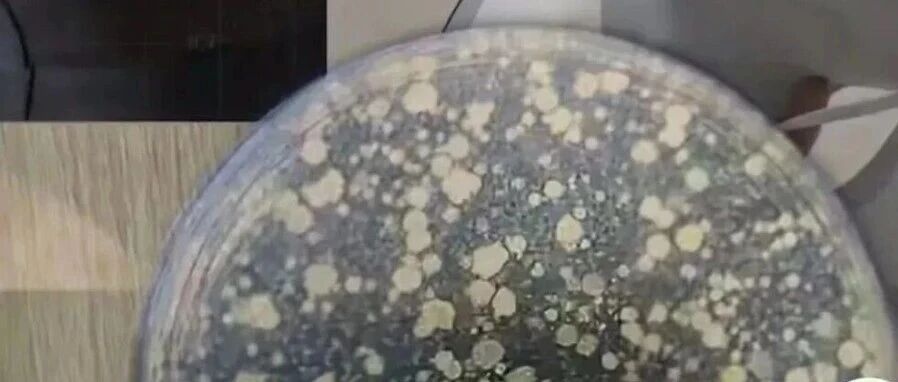 测出细菌、真菌几十万！夏天很多人天天用的这个物品，甚至比酒店浴巾还脏！